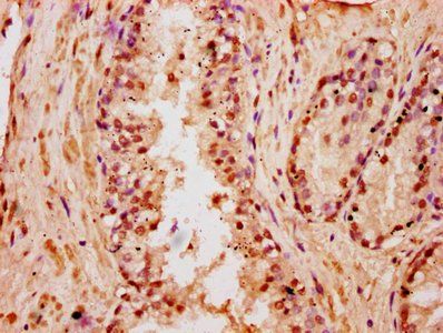 HIST1H3A (Ab-18) Antibody