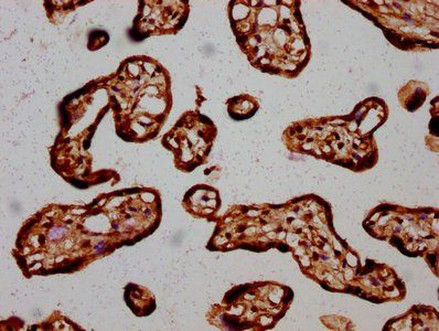 HIST1H3A (Ab-18) Antibody