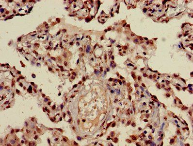 HIST1H3A (Ab-23) Antibody
