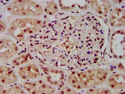 HIST1H3A (Ab-23) Antibody