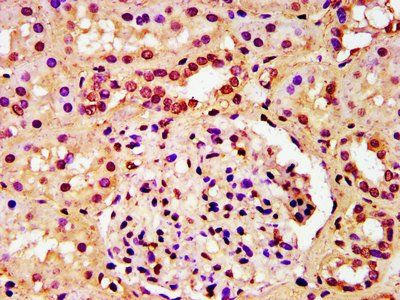 HIST1H3A (Ab-23) Antibody