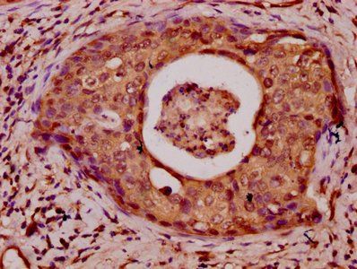 HIST1H3A (Ab-23) Antibody