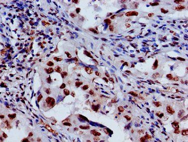 HIST1H3A (Ab-27) Antibody