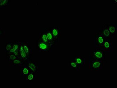 HIST1H3A (Ab-27) Antibody