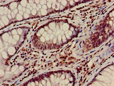 HIST1H3A (Ab-28) Antibody