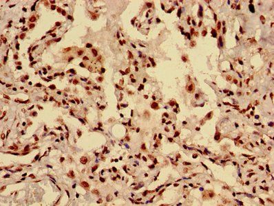 HIST1H3A (Ab-28) Antibody