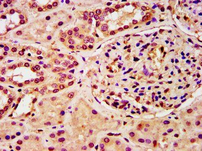HIST1H3A (Ab-28) Antibody