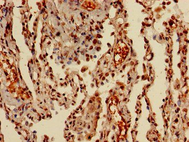 HIST1H3A (Ab-36) Antibody