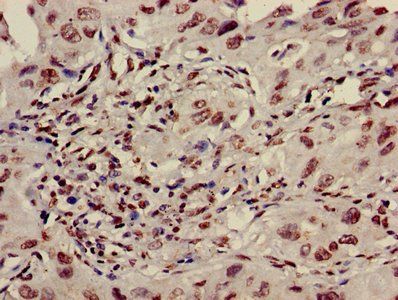 HIST1H3A (Ab-36) Antibody