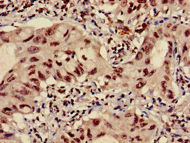 HIST1H3A (Ab-4) Antibody