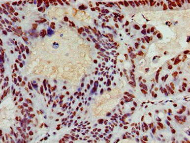HIST1H3A (Ab-4) Antibody