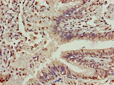 HIST1H3A (Ab-4) Antibody