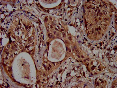 HIST1H3A (Ab-4) Antibody