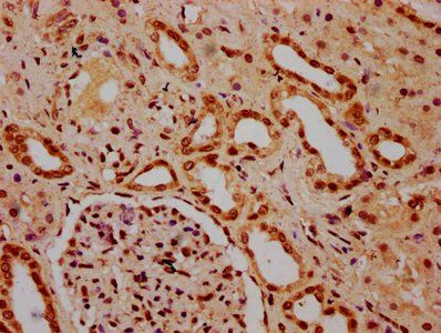 HIST1H3A (Ab-4) Antibody