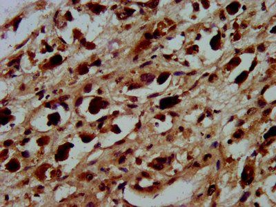 HIST1H3A (Ab-45) Antibody