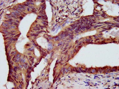 HIST1H3A (Ab-56) Antibody