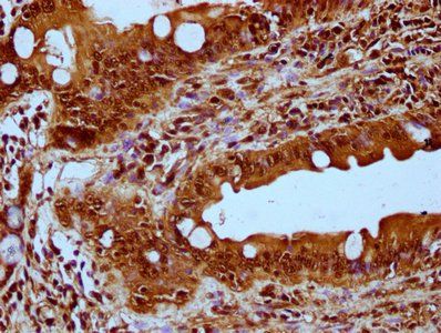 HIST1H3A (Ab-56) Antibody