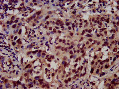 HIST1H3A (Ab-64) Antibody