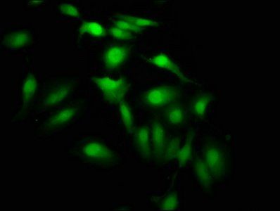 HIST1H3A (Ab-64) Antibody