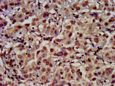 HIST1H3A (Ab-64) Antibody