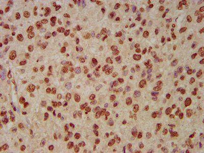 HIST1H3A (Ab-79) Antibody