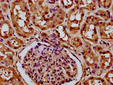 HIST1H3A (Ab-79) Antibody