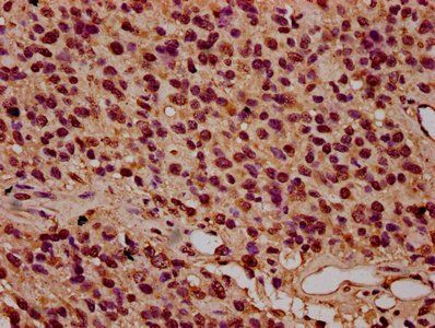 HIST1H3A (Ab-79) Antibody