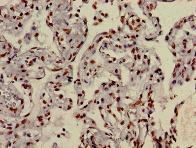 HIST1H3A (Ab-9) Antibody