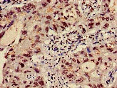 HIST1H3A (Ab-9) Antibody