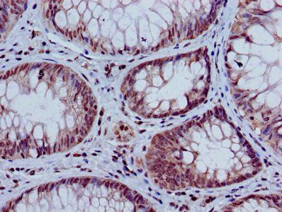HIST1H3A (Ab-9) Antibody