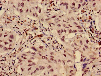 HIST1H3A (Ab-9) Antibody
