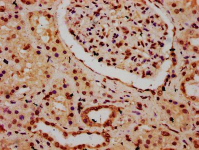 HIST1H3A (Ab-9) Antibody