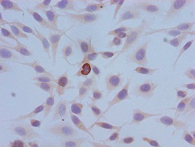 Phospho-HIST1H3A (S10) Antibody