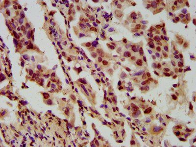 HIST1H4A (Ab-12) Antibody