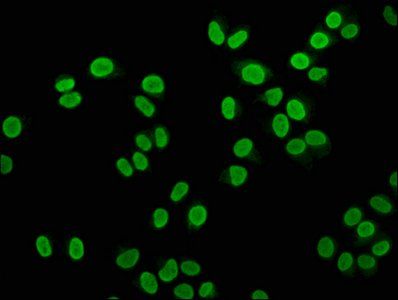 HIST1H4A (Ab-12) Antibody