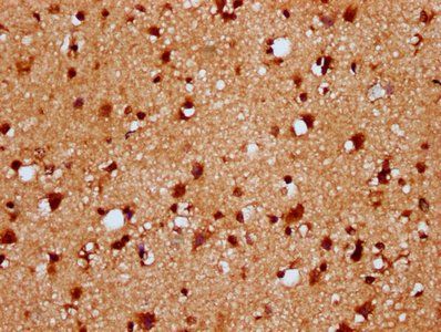 HIST1H4A (Ab-12) Antibody