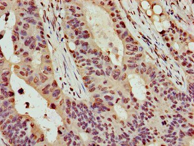 HIST1H4A (Ab-16) Antibody