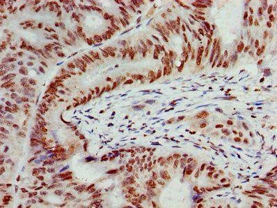 HIST1H4A (Ab-16) Antibody