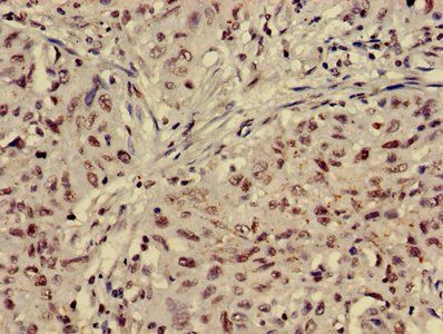 HIST1H4A (Ab-5) Antibody