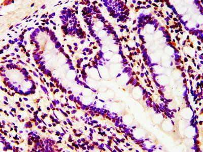 HIST1H4A (Ab-5) Antibody
