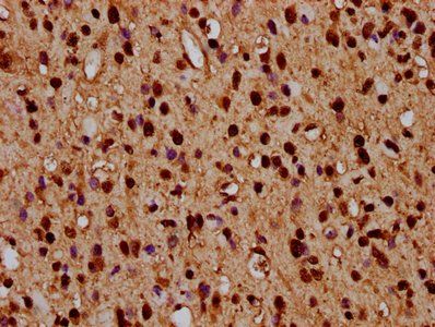 HIST1H4A (Ab-5) Antibody