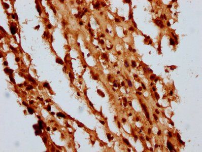HIST1H4A (Ab-5) Antibody