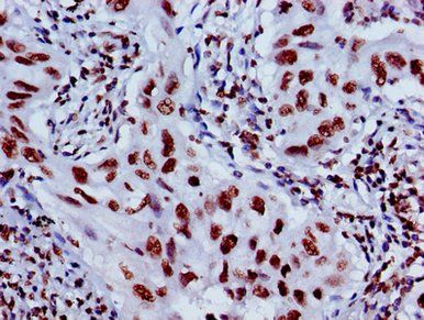 HIST1H4A (Ab-8) Antibody