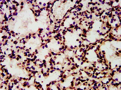 HIST1H4A (Ab-8) Antibody