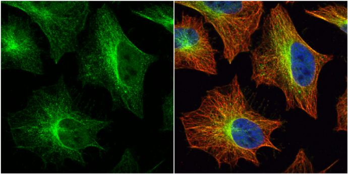 Histamine H2 Receptor antibody [N1], N-term