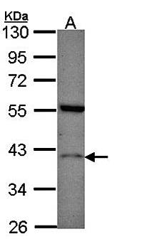 Histamine H2 Receptor antibody