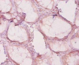 HDAC4 Antibody