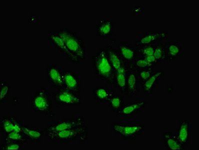 HDAC8 Antibody