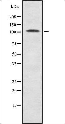 Histone deacetylase 9 antibody