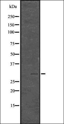 Histone H1.3+H1.4 (Phospho-T17) antibody